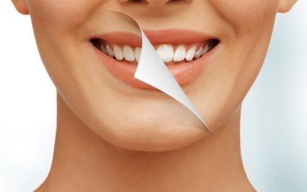 Diş Beyazlatma Teknikleri