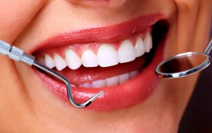 Doğal Diş Estetiği Tedavisi